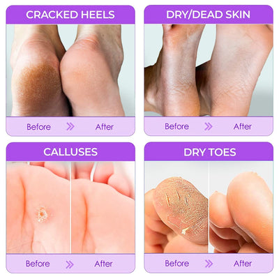 BioVitta Wellness™ Peeling Foot Masks | Get Baby-Soft Smooth Radiant Feet